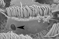 Cèl·lules cilíades que presenten trauma acustic