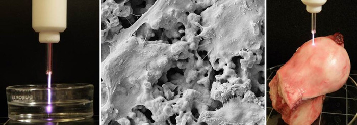 a l&rsquo;esquerra, tractament de medis líquids; a la dreta, tractament de teixits biològics amb feix de plasma atmosfèric. al centre, adhesió d&rsquo;osteoblastes en biomaterials ossis tractats amb plasma. 